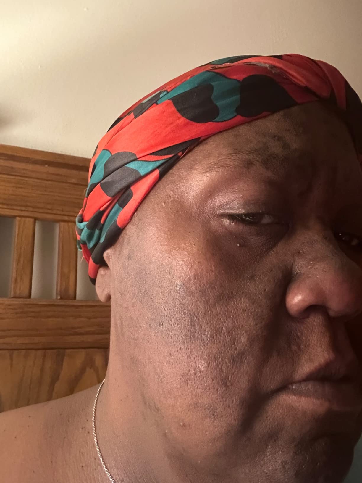 Before and After Result 1