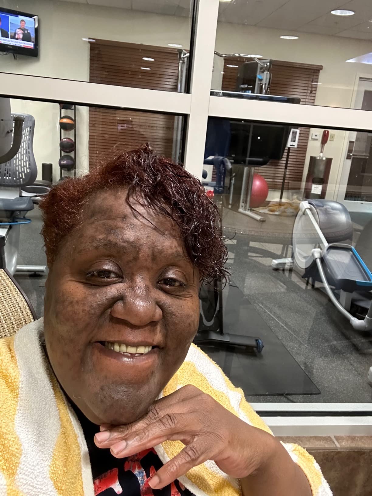 Before and After Result 4