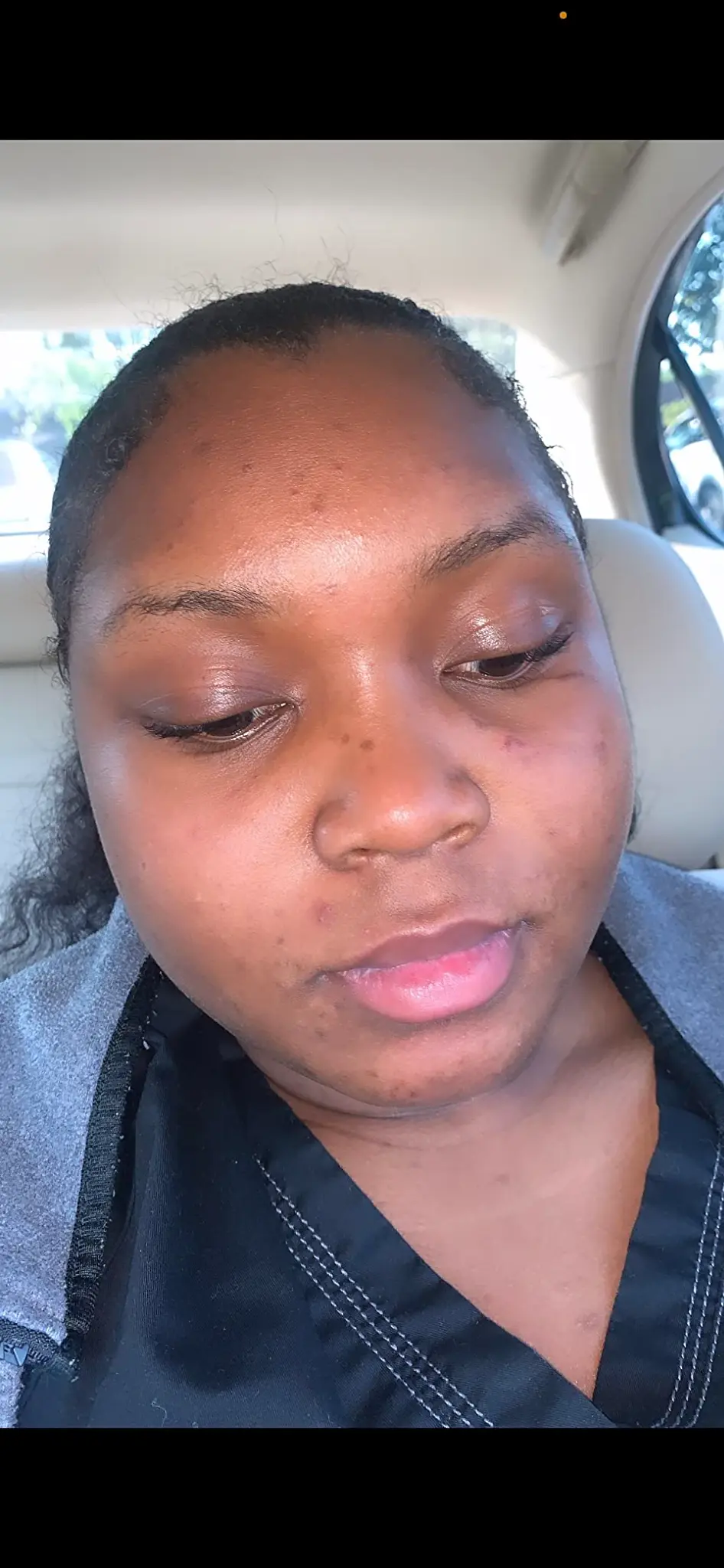 Before and After Result 6