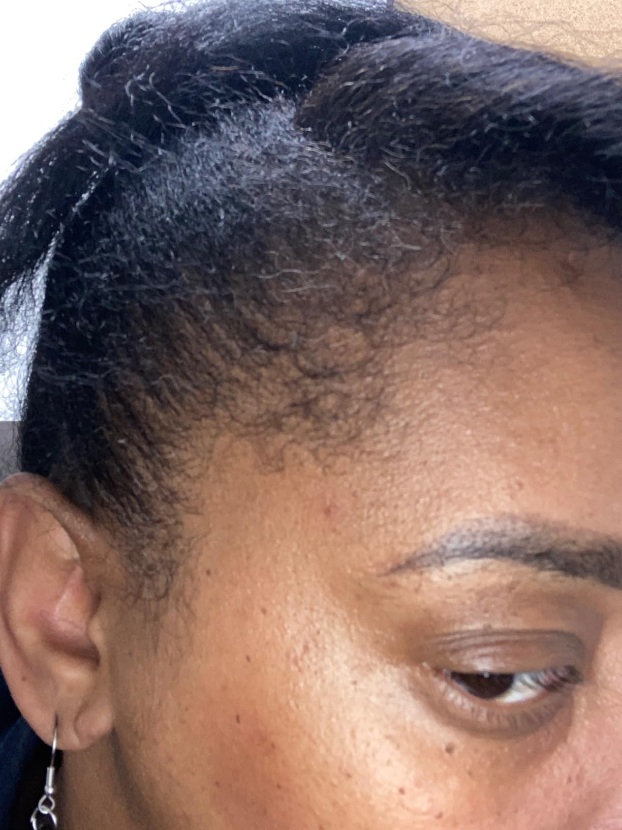 Before and After Result 2